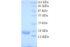 SDS-PAGE (SDS) image for Ropporin, Rhophilin Associated Protein 1B (ROPN1B) (AA 1-120) protein (His tag) (ABIN5713796)
