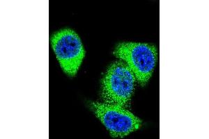 Confocal immunofluorescent analysis of TOP2A Antibody (C-term) with Hela cell followed by Alexa Fluor 488-conjugated goat anti-rabbit lgG (green). (Topoisomerase II alpha anticorps  (C-Term))