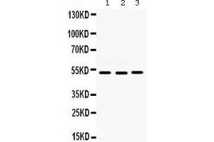 Western blot analysis of Cdc25C expression in HELA whole cell lysates (lane 1), SW620 whole cell lysates (lane 2) and MCF-7 whole cell lysates (lane 3). (CDC25C anticorps  (C-Term))
