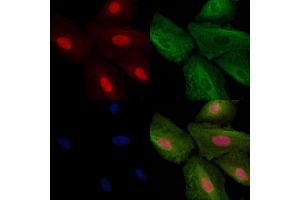 ABIN6257756 and ABIN6273652 staining  cells by IF/ICC. (IL16 anticorps  (C-Term))