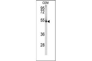 Image no. 1 for anti-Protein Kinase, CAMP-Dependent, Regulatory, Type I, alpha (Tissue Specific Extinguisher 1) (PRKAR1A) (N-Term) antibody (ABIN360569) (PRKAR1A anticorps  (N-Term))