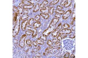 IHC analysis of KMO using anti-KMO antibody (ABIN7600958). (KMO anticorps  (AA 26-372))