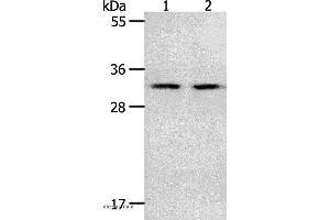 Western blot analysis of Mouse spleen and intestinum crassum tissue, using NME6 Polyclonal Antibody at dilution of 1:400 (NME6 anticorps)