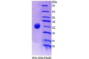 SDS-PAGE of Protein Standard from the Kit (Highly purified E.