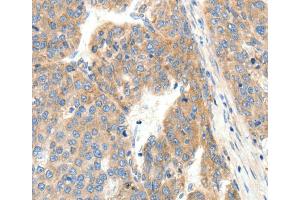 Immunohistochemistry (IHC) image for anti-Collagen, Type IV, alpha 1 (COL4A1) antibody (ABIN2431191) (COL4A1 anticorps)