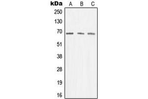 Western blot analysis of Menin expression in K562 (A), Jurkat (B), A431 (C) whole cell lysates. (Menin anticorps  (Center))