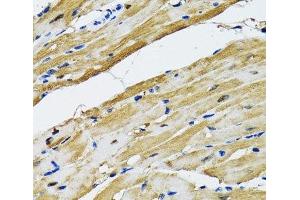 Immunohistochemistry of paraffin-embedded Rat heart using GOT1 Polyclonal Antibody at dilution of 1:100 (40x lens).