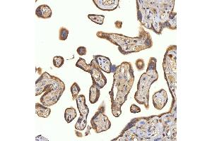 IHC analysis of SRPRA using anti-SRPRA antibody (ABIN7601408). (SRPRA (AA 346-638) anticorps)