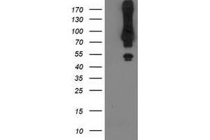 Western Blotting (WB) image for anti-Mahogunin, Ring Finger 1 (MGRN1) antibody (ABIN1499459) (Mahogunin RING Finger Protein 1 anticorps)
