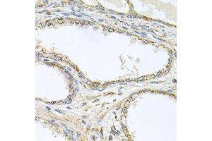 Immunohistochemistry of paraffin-embedded human prostate using TNFRSF10A antibody. (TNFRSF10A anticorps  (AA 269-468))