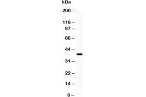 Western blot testing of SIRT3 antibody and recombinant human protein (0. (SIRT3 anticorps  (AA 66-399))
