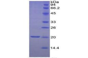 SDS-PAGE of Protein Standard from the Kit  (Highly purified E.