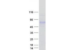 Validation with Western Blot