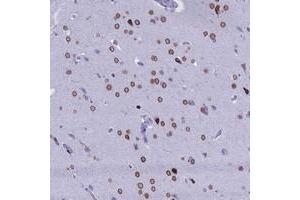 Immunohistochemical staining of human cerebral cortex with FAM169A polyclonal antibody  at 1:200-1:500 dilution. (FAM169A anticorps)