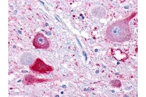 Immunohistochemical staining of Brain (Neurons) using anti- NPFFR1 antibody ABIN122333 (NPFFR1 anticorps)