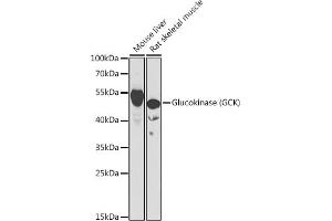 Western blot analysis of extracts of various cell lines, using Glucokinase (Glucokinase (GCK)) antibody (ABIN6131694, ABIN6141012, ABIN6141013 and ABIN6221893) at 1:1000 dilution.