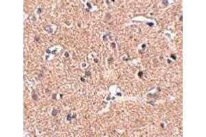 anti-UDP-N-Acetyl-alpha-D-Galactosamine:polypeptide N-Acetylgalactosaminyltransferase 10 (GalNAc-T10) (GALNT10) (N-Term) antibody