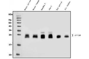 Western blot analysis of GILT/IFI30 using anti-GILT/IFI30 antibody (ABIN7601299). (IFI30 anticorps  (AA 32-248))