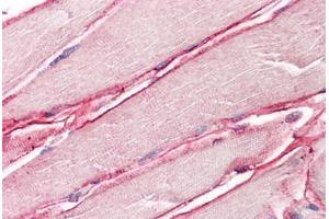 Image no. 2 for anti-Sarcoglycan, delta (35kDa Dystrophin-Associated Glycoprotein) (SGCD) (AA 244-256) antibody (ABIN1496154) (SGCD anticorps  (AA 244-256))