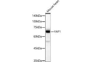 Western blot analysis of extracts of Mouse heart, using Y antibody (ABIN7271418) at 1:20000 dilution. (YAP1 anticorps)