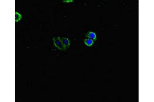 Immunofluorescent analysis of HepG2 cells using ABIN7157008 at dilution of 1:100 and Alexa Fluor 488-congugated AffiniPure Goat Anti-Rabbit IgG(H+L) (Inversin anticorps  (AA 1-101))