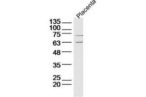 Lane 1: Mouse placenta lysate probed with Deltex 1 Polyclonal Antibody Unconjugated  at 1:300 overnight at 4˚C. (Deltex Homolog 1 anticorps  (AA 351-450))