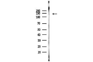 anti-Myosin Phosphatase, Target Subunit 1 (PPP1R12A) (pThr696) antibody
