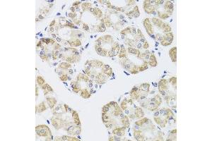 Immunohistochemistry of paraffin-embedded human stomach using PPP1CC antibody.