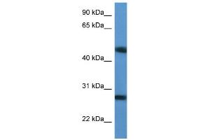 WB Suggested Anti-TM2D2 Antibody Titration: 0. (TM2D2 anticorps  (Middle Region))