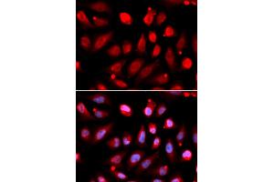 Immunofluorescence analysis of U2OS cells using EZH2 antibody.