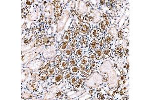 IHC analysis of SLC4A1 using anti-SLC4A1 antibody (ABIN3043930).