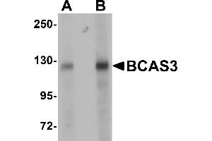 Western Blotting (WB) image for anti-Breast Carcinoma Amplified Sequence 3 (BCAS3) (N-Term) antibody (ABIN1031263) (BCAS3 anticorps  (N-Term))