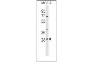 Western blot analysis of SRPRB Antibody (C-term) in MCF-7 cell line lysates (35ug/lane). (SRPRB anticorps  (C-Term))