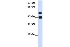 Western Blotting (WB) image for anti-Ubiquitin Specific Peptidase 22 (USP22) antibody (ABIN2460039) (USP22 anticorps)