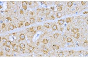 Immunohistochemistry of paraffin-embedded Rat brain using HSP90AA1 Polyclonal Antibody at dilution of 1:200 (40x lens).