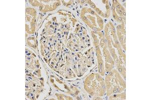 Immunohistochemistry (IHC) image for anti-HUS1 Checkpoint Homolog (S. Pombe) (HUS1) antibody (ABIN1876595) (HUS1 anticorps)