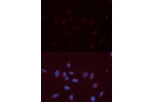 Immunofluorescence (IF) image for anti-Amyloid beta (A4) Precursor-Like Protein 2 (APLP2) antibody (ABIN1876643) (APLP2 anticorps)