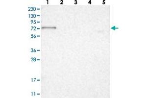 Western blot analysis of Lane 1: RT-4, Lane 2: U-251 MG, Lane 3: Human Plasma, Lane 4: Liver, Lane 5: Tonsil with RUNDC1 polyclonal antibody  at 1:250-1:500 dilution.