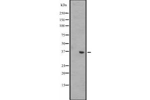 Western blot analysis of WNT8B expression in A431 whole cell lysate ,The lane on the left is treated with the antigen-specific peptide. (WNT8B anticorps  (Internal Region))