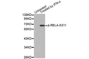 Western blot analysis of extracts from Hela cells, using Phospho-RELA-S311 antibody. (NF-kB p65 anticorps  (pSer311))
