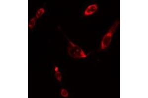 ABIN6275599 staining Hela cells by IF/ICC. (SOS2 anticorps  (Internal Region))