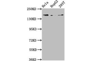 Western Blot Positive WB detected in: Hela whole cell lysate, HepG2 whole cell lysate, 293T whole cell lysate All lanes: C4A antibody at 3. (C4A anticorps  (AA 1027-1186))