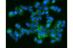 IF analysis of CD9 using anti-CD9 antibody (ABIN4886531). (CD9 anticorps  (AA 110-193))