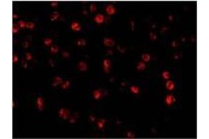AP20057PU-N Beclin-1 antibody staining of A431 cells by Immunofluorescence at 2 μg/ml. (Beclin 1 anticorps  (C-Term))