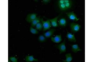 Immunofluorescence staining of A549 cells with ABIN7146877 at 1:50, counter-stained with DAPI. (CSNK1G3 anticorps  (Isoform gamma 3))
