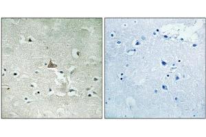 Immunohistochemical analysis of paraffin-embedded human brain tissue using Trk B (Phospho-Tyr706/Tyr707) antibody (left)or the same antibody preincubated with blocking peptide (right). (TRKB anticorps  (pTyr706, pTyr707))