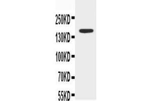 Anti-ABCB4 antibody, Western blotting WB: MCF-7 Cell Lysate