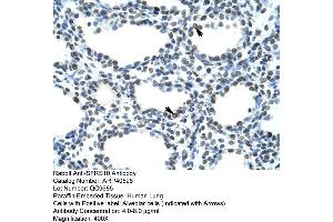 Rabbit Anti-SFRS10 Antibody  Paraffin Embedded Tissue: Human Lung Cellular Data: Alveolar cells Antibody Concentration: 4. (TRA2B anticorps  (N-Term))