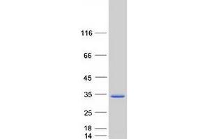 Validation with Western Blot