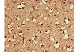 Immunohistochemistry of paraffin-embedded human brain tissue using ABIN7145729 at dilution of 1:100 (BAIAP2 anticorps  (AA 123-368))